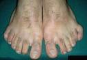 6toes.jpg